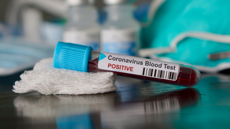 Ученик от карловско училище с положителен бърз тест за коронавирус