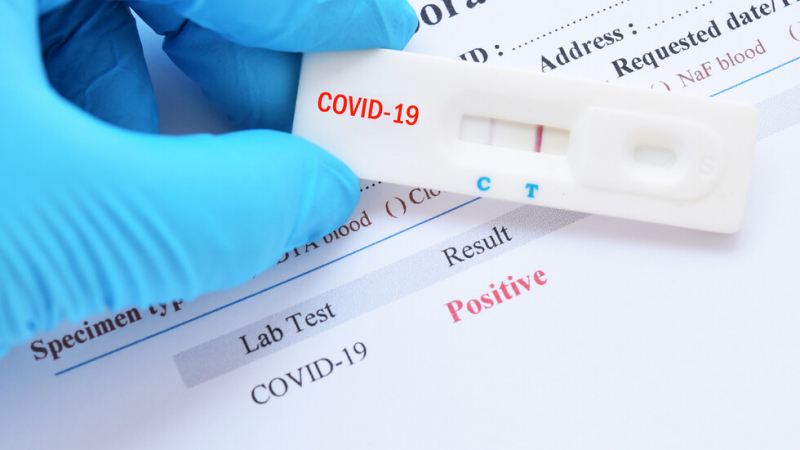 Ужасяващ рекорд: 330 заразени с COVID-19 за 24 часа у нас, но това не е всичко 