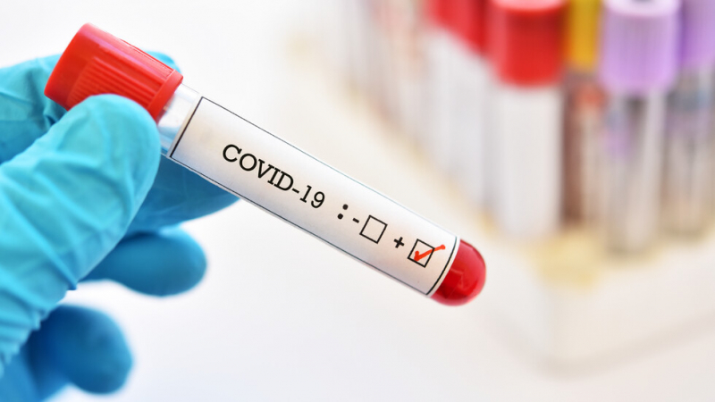 Казаха кои от заразените с коронавирус са по-опасни 