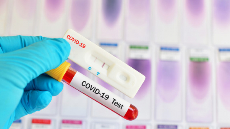 Странно съвпадение: Един и същ брой заразени от COVID-19 в 2 поредни дни 
