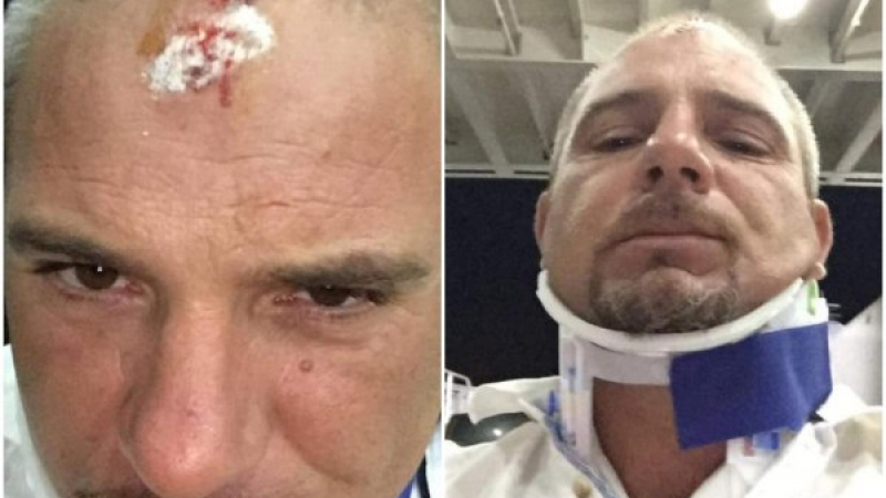 Българин си разби главата на Тасос и ето какво му се случи в болница в Кавала СНИМКИ 