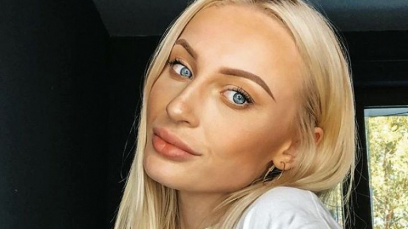 Ослепителна блондинка показа как изглежда красивото й лице след година и половина в Ада СНИМКИ