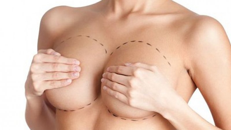 Разкриха може ли крем за уголемяване на бюста за 69 лева да замести операцията