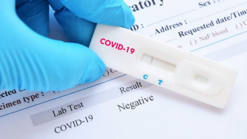 Турски лекар изобрети тест за коронавирус с урина 