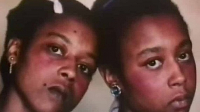 Историята на близначките Гибънс, които сключиха пакт за смърт, ужаси света 