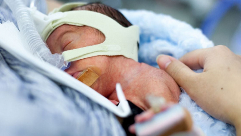 Лошо: Пандемичните мерки са фатални за недоносените бебета