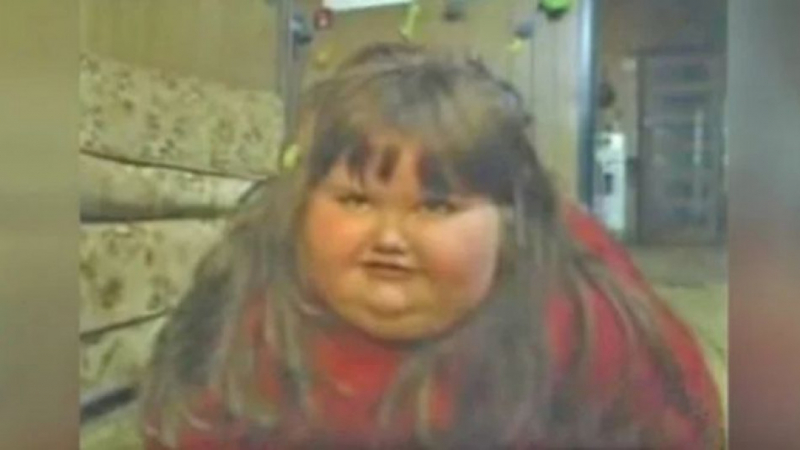 8-г. момиче тежеше 200 кг, сега е истинска красавица СНИМКИ