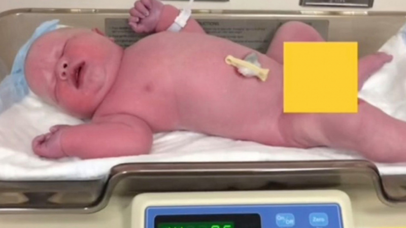 Майка роди бебе гигант и показа как изглежда 5 години по-късно 