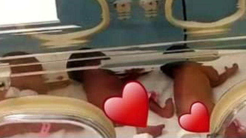 Куриоз: Жена роди 9 бебета наведнъж 