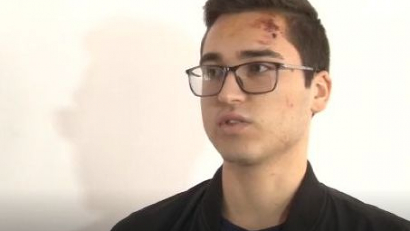 Ученикът, бит от полицай: Свали ми очилата с шамар ВИДЕО