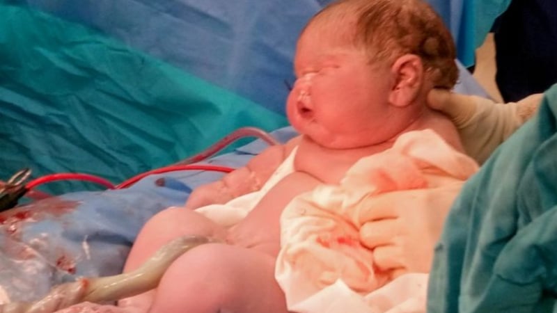 Майка със спирала ошашави лекарите с гигантското си бебе СНИМКИ 