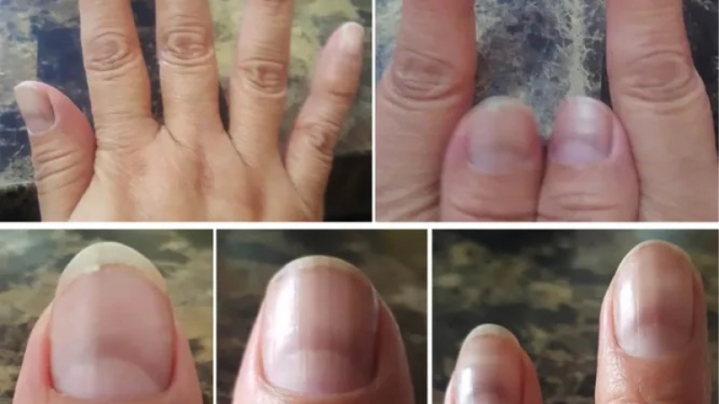Как да разберем по ноктите, че сме преболедували К-19 