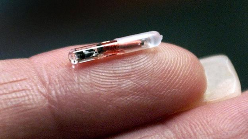 Случи се: В Швеция вече имплантират ковид чип под кожата