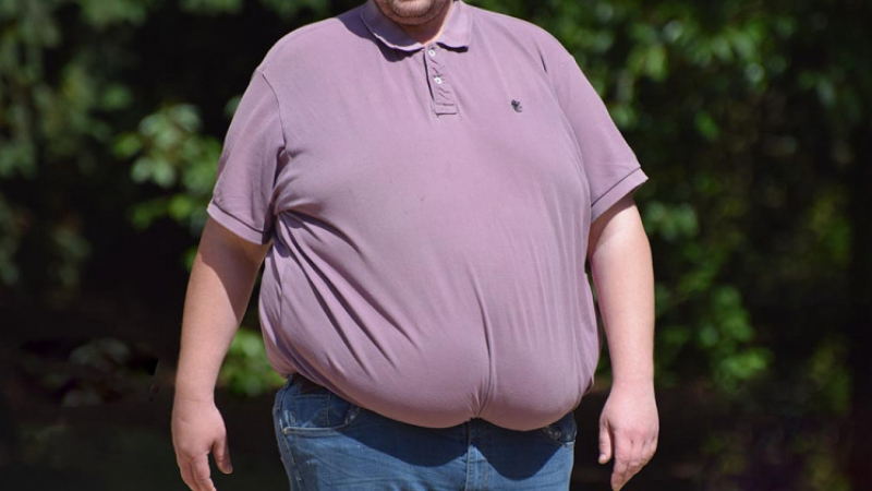 Д-р Спас Иванов: Болестното затлъстяване е епидемия