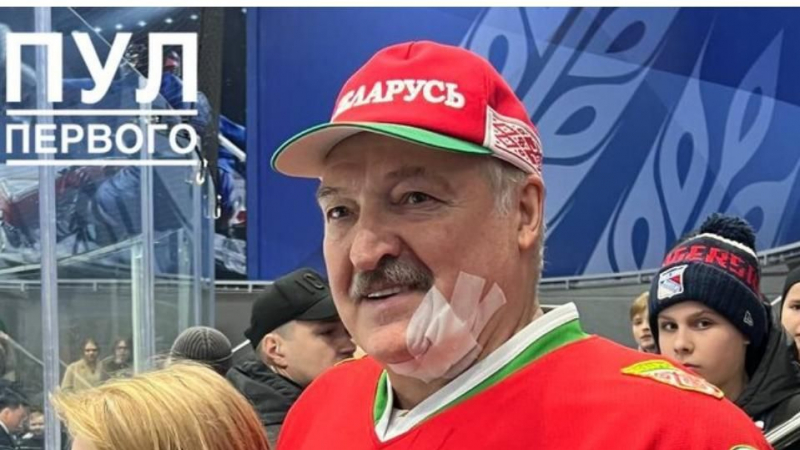 Окървавиха Александър Лукашенко, наложи се да го шият ВИДЕО
