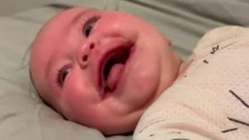 Това бебе не спира да се усмихва, причината е зловеща