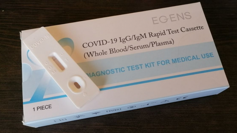 Горещи новини за антигенните ковид тестове