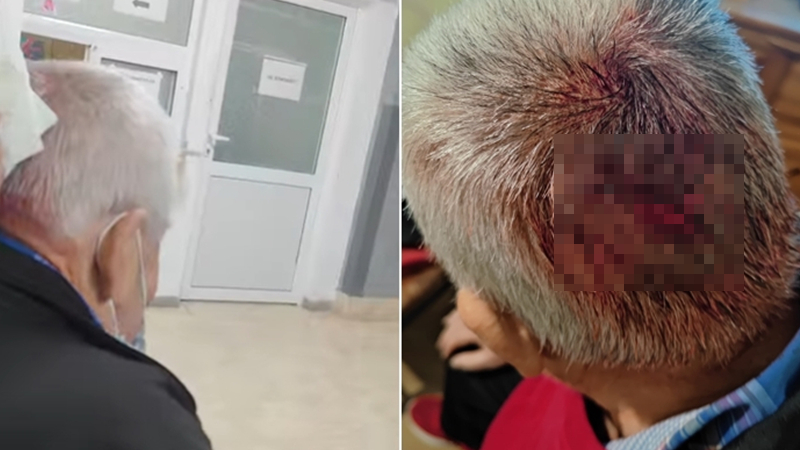 Пълен шок! Мъж отиде със сцепена глава в болница в Стара Загора, пратиха го в гинекологията ВИДЕО 18+