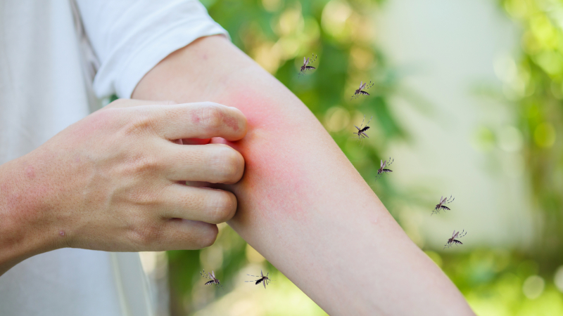 Ухапвания и ужилвания от насекоми - ето каква е разликата и как да намалим болката