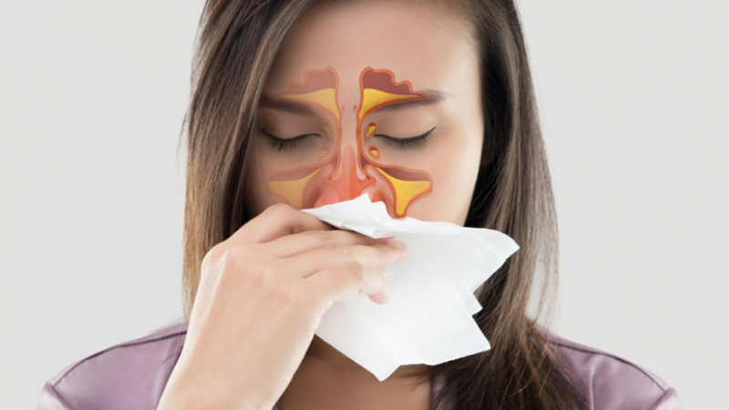 Eто как да различим обикновената настинка от синузита