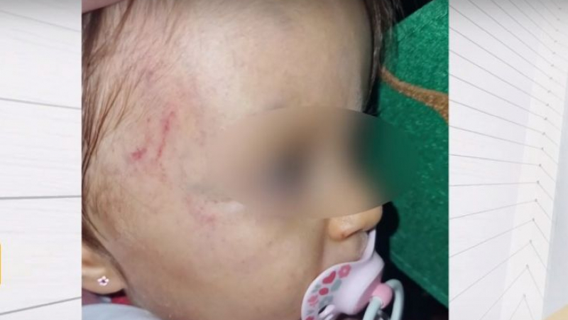 Скандално: Детски център върна 1-г. дете с кръвоизливи и синини по главата на майката ВИДЕО