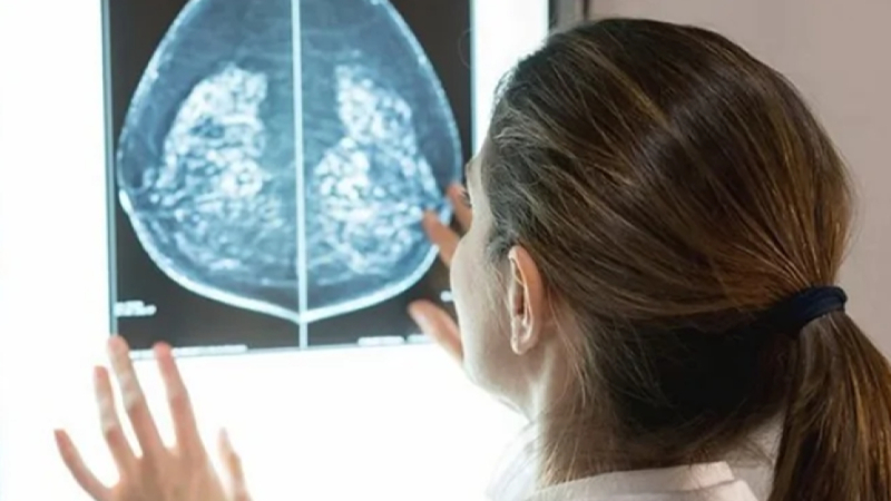 СЗО с плашеща прогноза: До 2025 година се очаква драстичен скок на пациентите с рак
