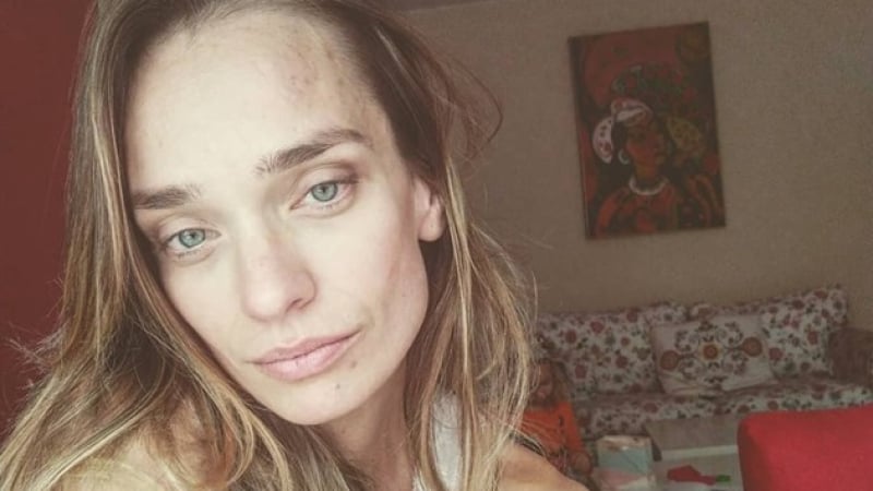 Ирена Милянкова се обезобрази заради нов любовник СНИМКА