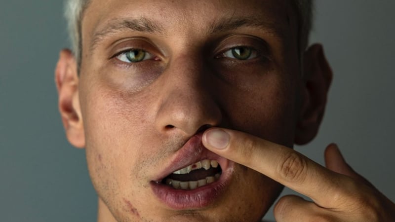 Див екшън в Пловдив: Охранители потрошиха от бой певец, счупиха му зъбите СНИМКИ 18+