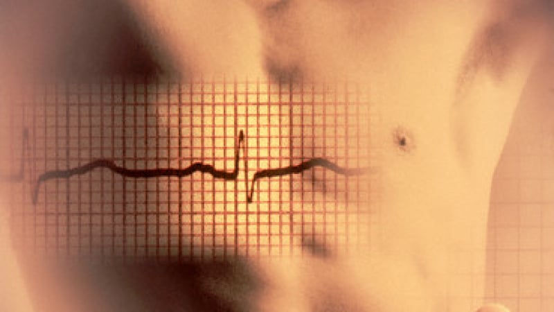 Д-р Мария Коларова, кардиолог: Ехокардиографията “изписва” състоянието на сърцето