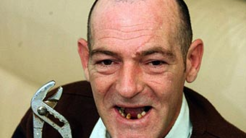 Ветеран от войната в Ирак си извади 13 зъба с клещи