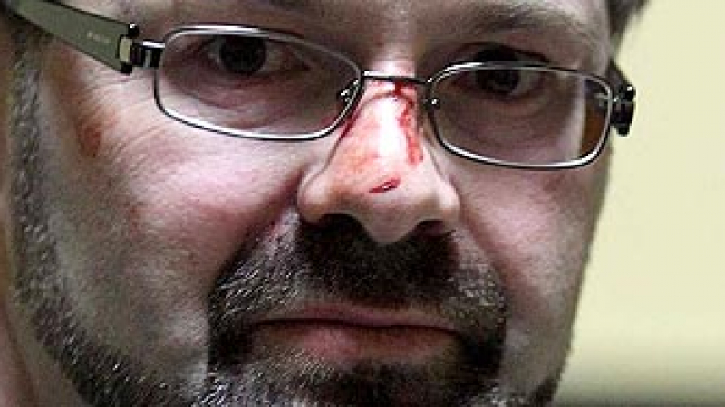 Счупен нос след депутатски бой в Скупщината на Сърбия