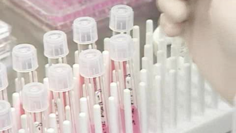 25 случая на свински грип са регистрирани у нас за седмица 