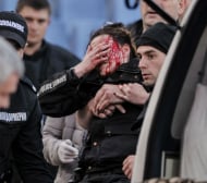 Спасиха ли зрението на полицайката от ЦСКА - Левски?