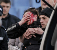 Продължават проблемите за ранената полицайка на ЦСКА - Левски 