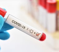 Наш треньор: Изкарал съм COVID-19, оказа се, че имам антитела