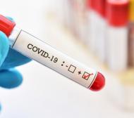 Нови 12 положителни случая на коронавирус преди Олимпиадата
