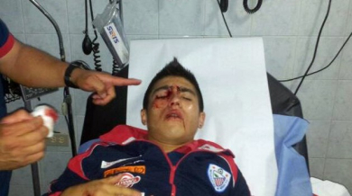 Футболист едва не остана без око във Венецуела