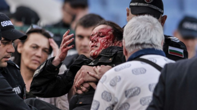 Страшен шок! Окървавената полицайка се бори за зрението си! Безпрецедентна акция сред феновете на Левски