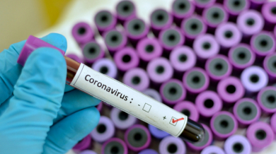 Важно решение за мач от елита заради коронавирус