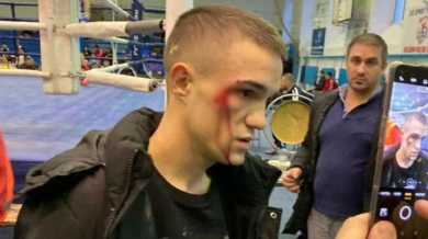 Кървав спор! Треньор счупи главата на шампион по бокс ВИДЕО