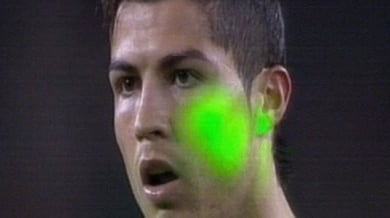 Лазерът можел да изгори ретината на Роналдо