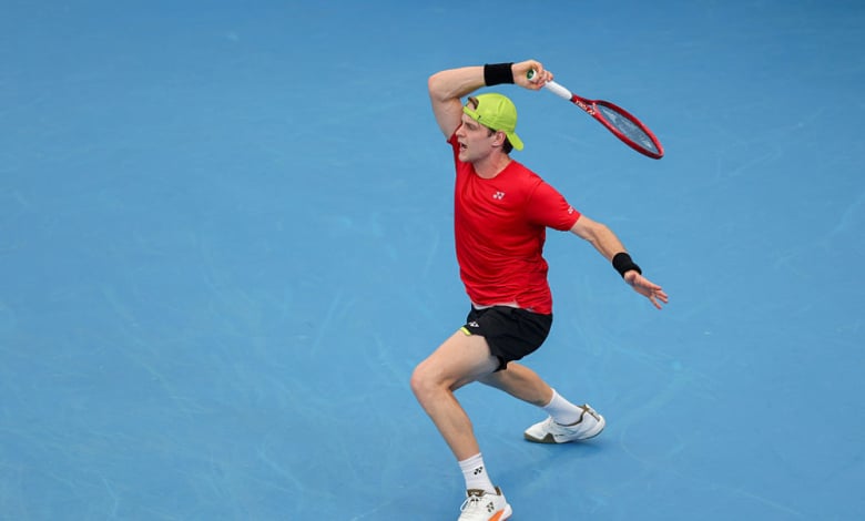 Getty Images/Guliver