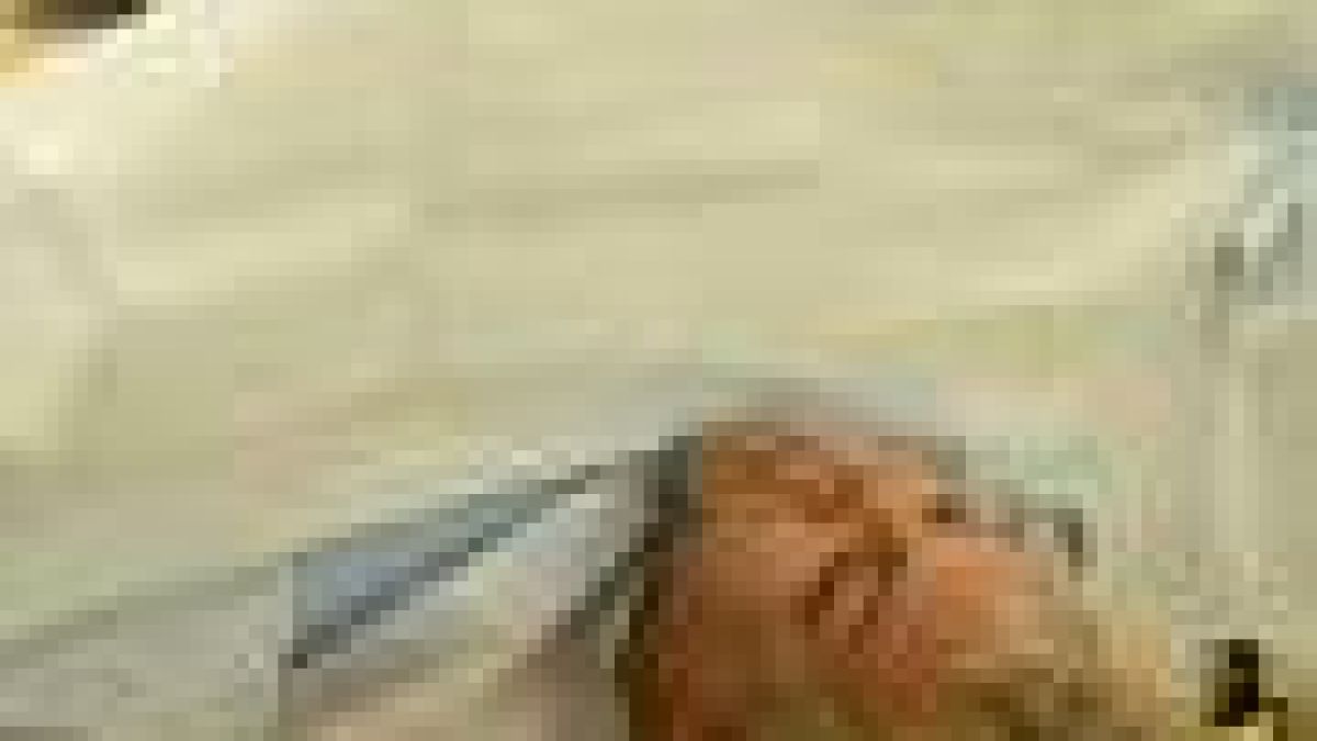 Азис ще си прави лифтинг на цялото тяло