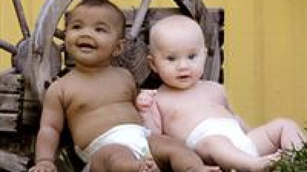 Родиха се близнаци с различен цвят на кожата
