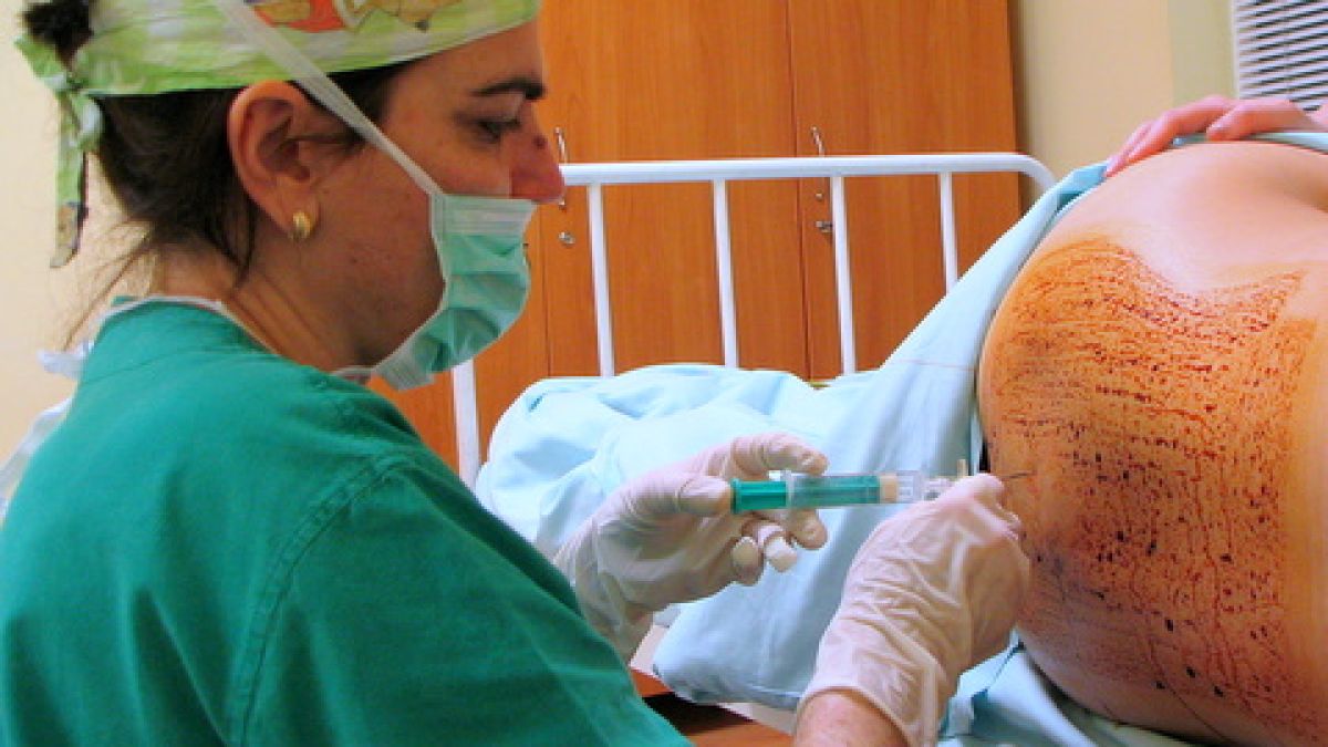 35-40% са родили с цезарово сечение през 2008 г. 