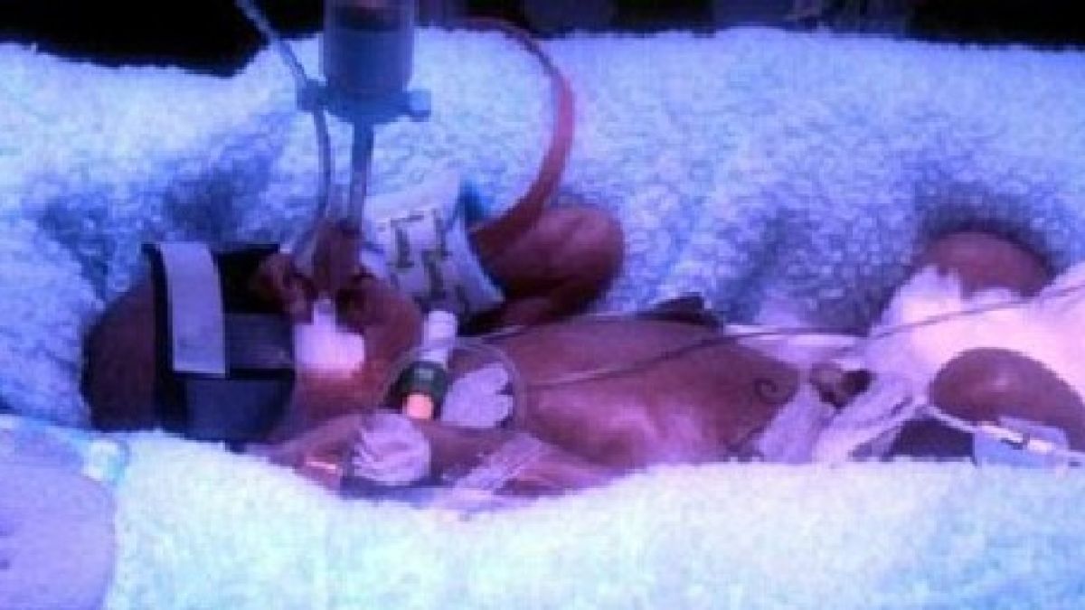 Бебе умря в утробата на майка си и после възкръсна 