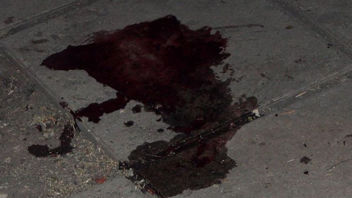 Пребиха жестоко 22-годишен младеж в Благоевград 