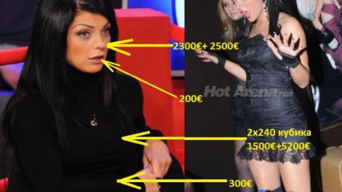 Емануела си оперирала носа за 2500 евро
