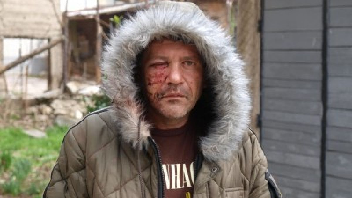 Комшия преби зверски екоексперт