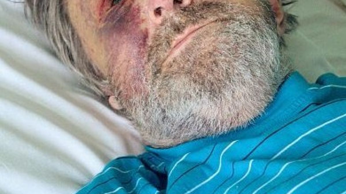 Син преби зверски родния си баща 